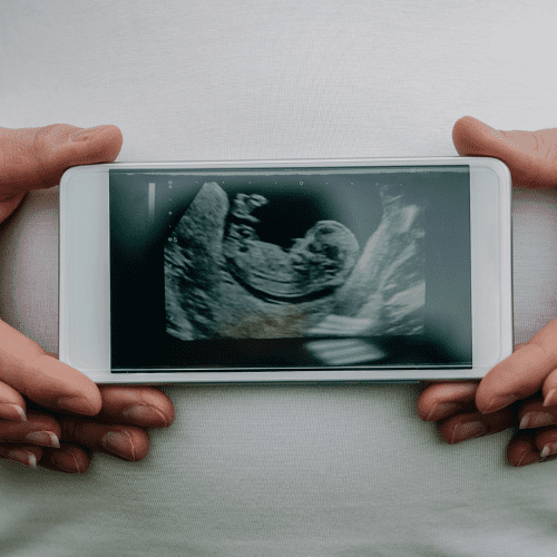 30+ Ways To Announce A Pregnancy