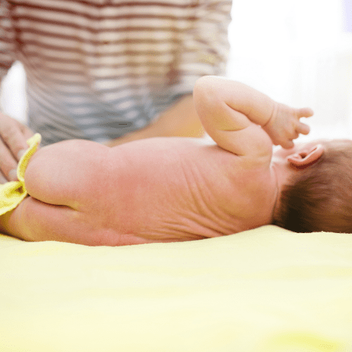 My newborn’s stool is white – is it Undigested milk?