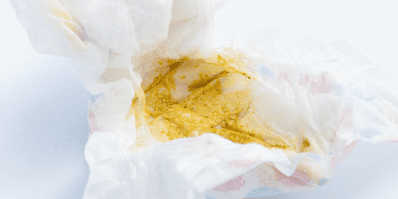 My newborn’s stool is white - is it Undigested milk? - Mama of Five