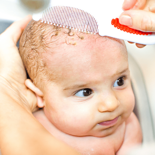 Does Cradle Cap Smell?