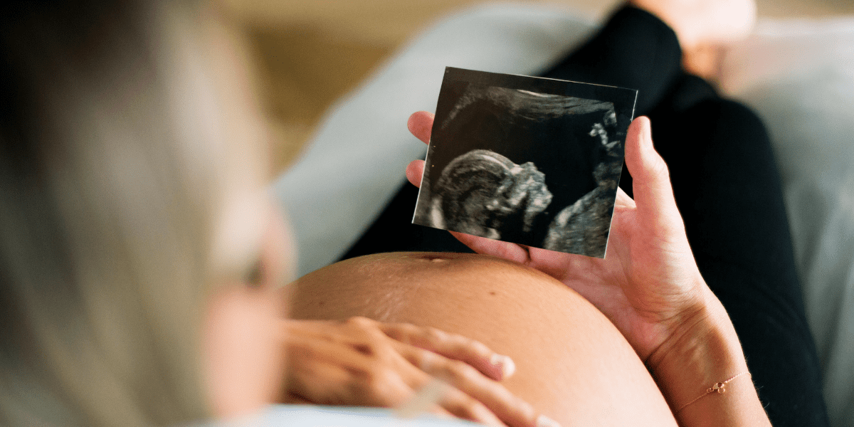 pregnant woman holding up a scan